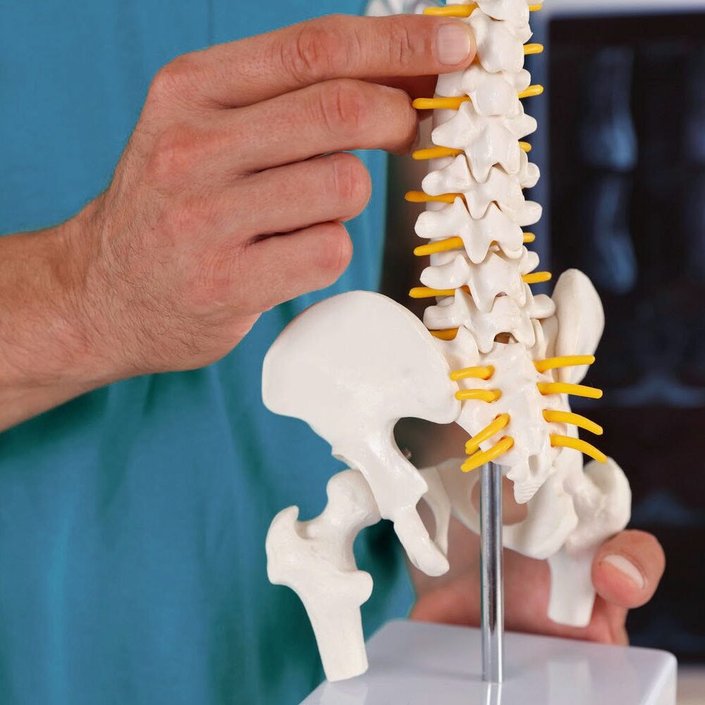 Healthcare provider using a spine model to explain how decompression relieves pressure on discs and nerves.