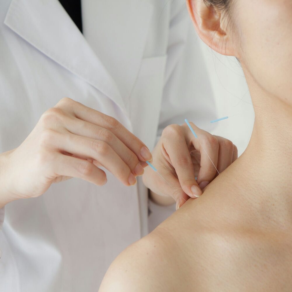 Therapist performing shoulder massage on a patient for pain relief